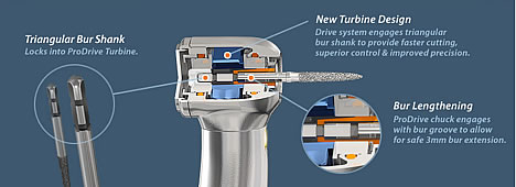 Prodrive Turbine Assembly